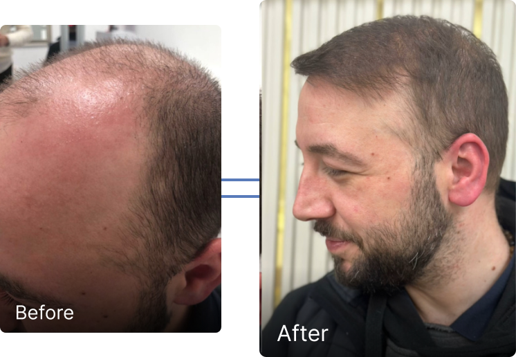 Before and after result 1