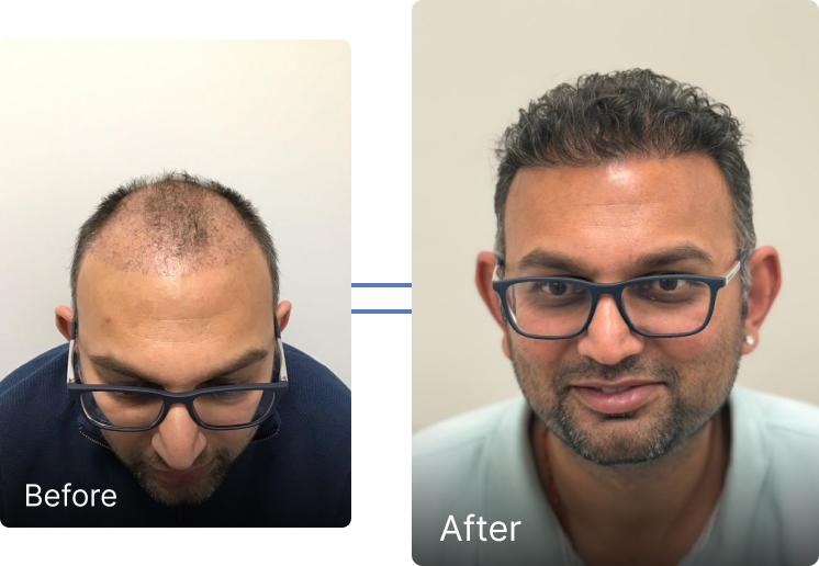 Before and after result 3